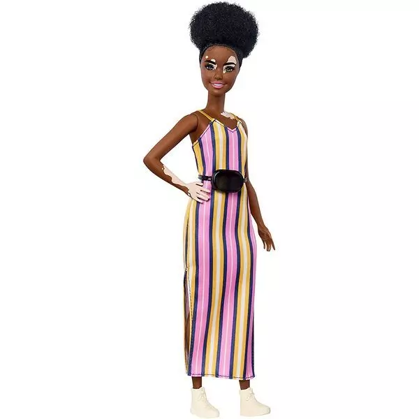 Barbie Fashionistas: Barna, vitiligo bőrű baba