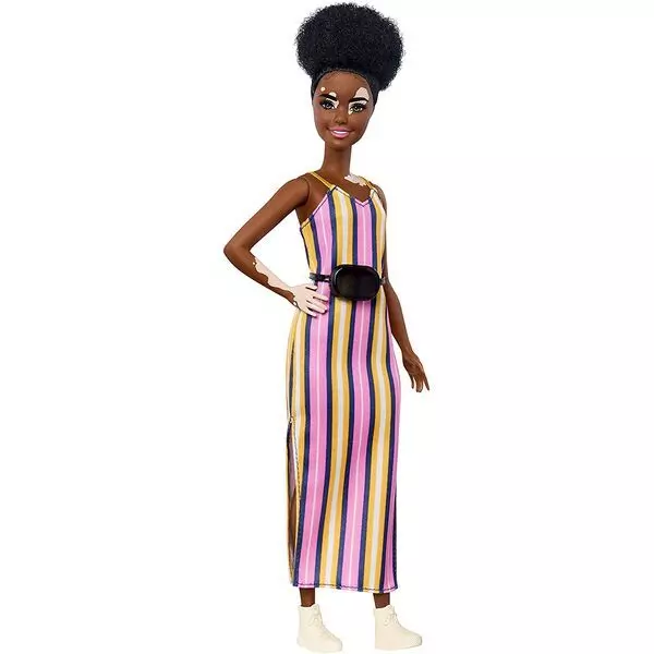 Barbie Fashionistas: Păpușă creol cu vitiligo